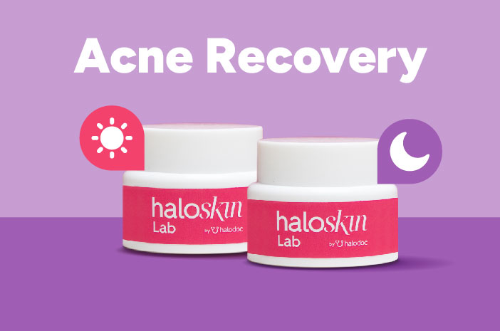 skincare jerawat haloskin